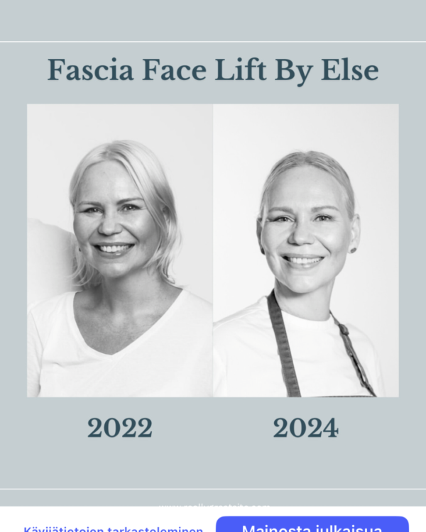 Fascia Face Lift By Else, RISE30